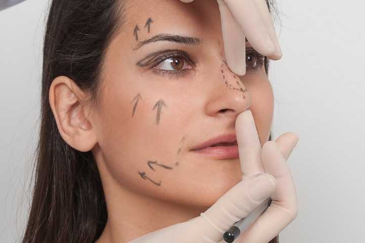 Rinoplastia