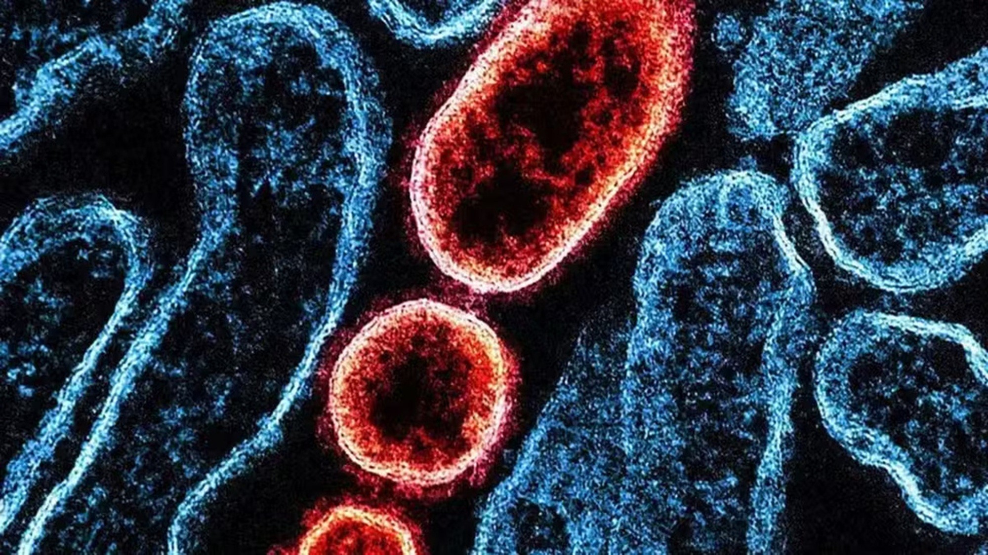 É #FAKE que OMS emitiu alerta de risco global para o vírus Nipah após o Carnaval