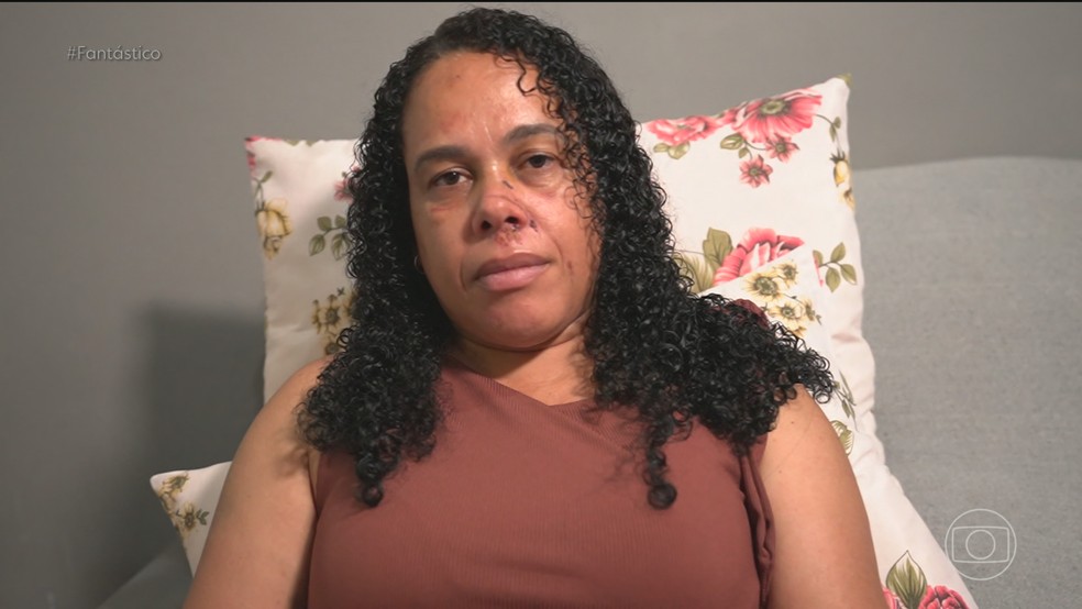'Sempre com a faca apertando muito meu pescoço', conta mulher que sobreviveu após ser jogada de penhasco pelo ex-companheiro — Foto: Fantástico/ Reprodução